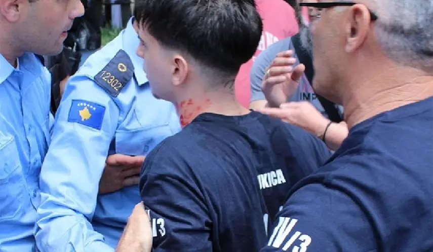 Excessive use of force by the so-called Kosovo police against a minor from a group of Serb high school graduates who were celebrating the end of the school year on the main promenade.