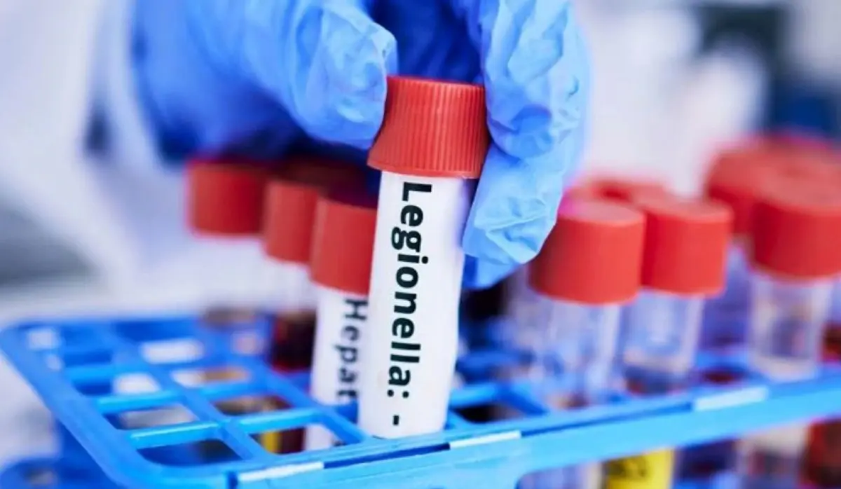 PRESENCE OF LEGIONELLA BACTERIA CONFIRMED AT THE FACULTY OF ECONOMICS