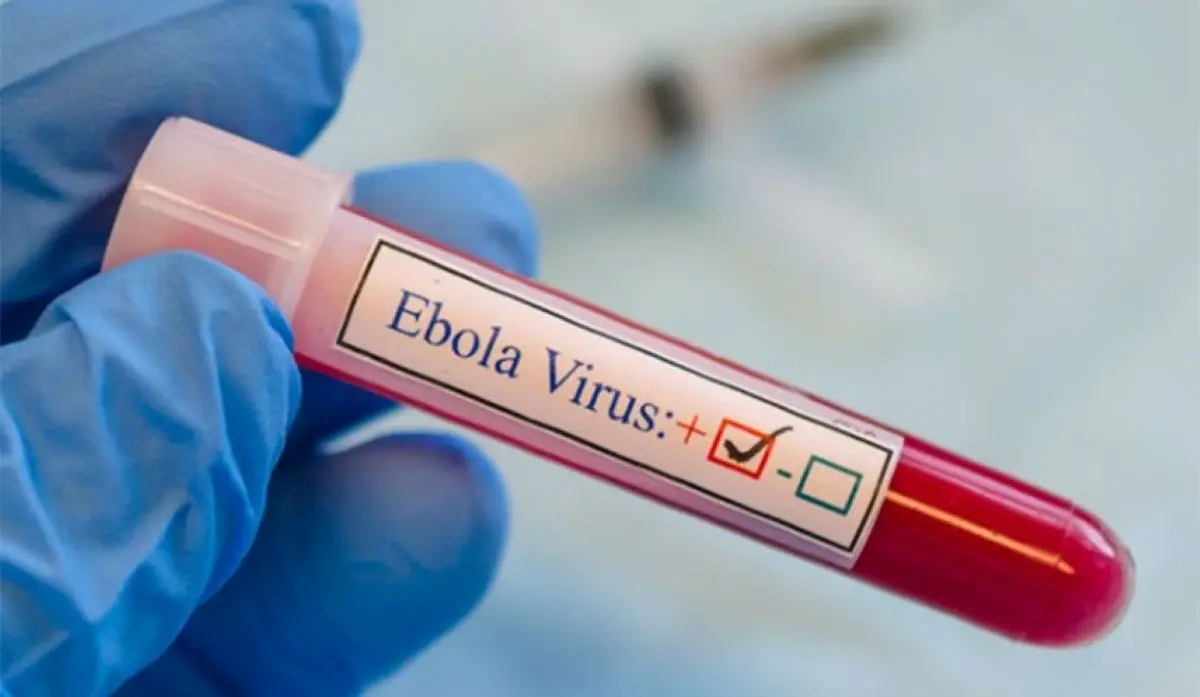 FRANCE REPORTS EBOLA CASE