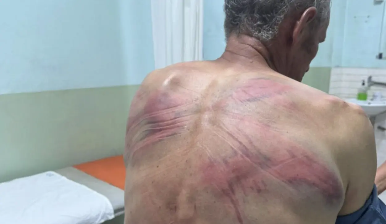 PETKOVIĆ: NENAD’S INJURIES MUST NOT GO UNPUNISHED!