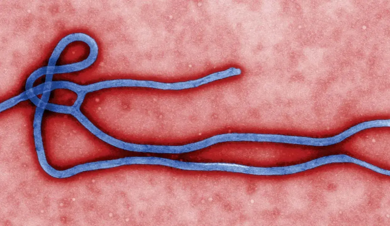TEST FOR EARLY DETECTION OF BUNDIBUGYO VIRUS DEVELOPED